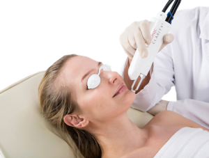 Woman getting clarity laser treatment