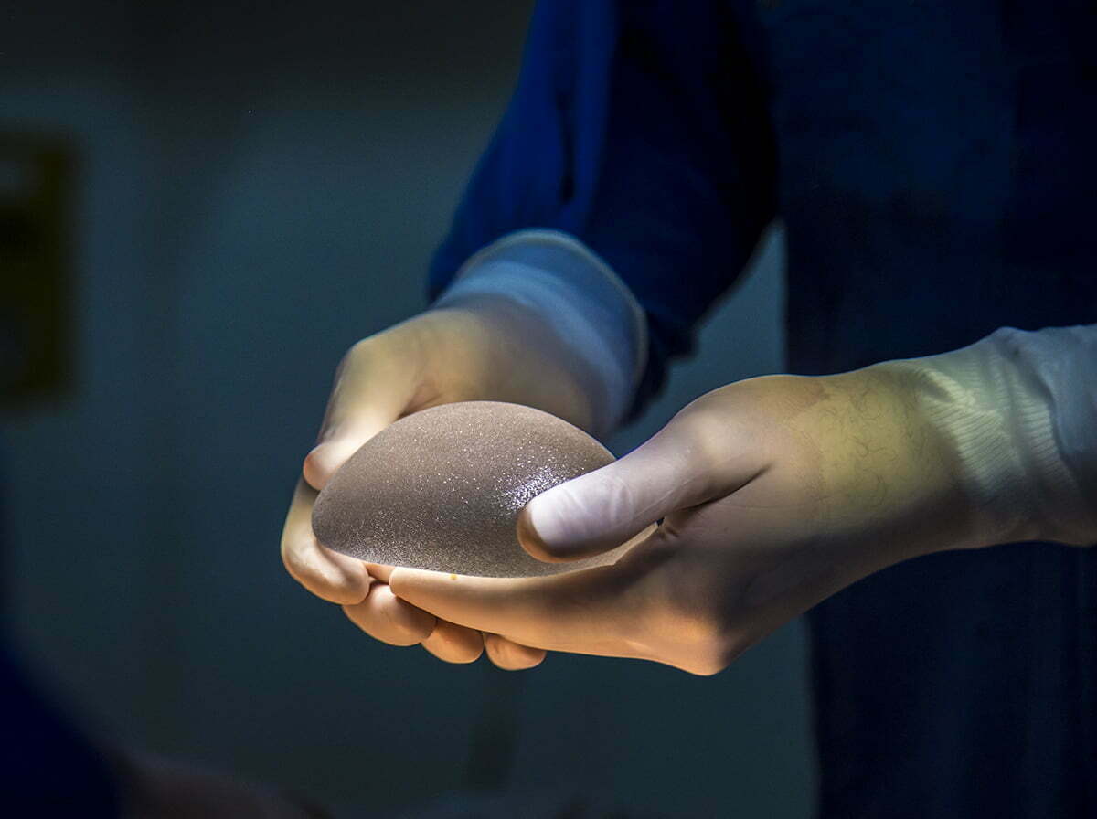 Surgeon holding textured breast implant