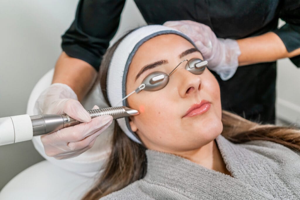 Woman getting a fractional laser skin resurfacing treatment