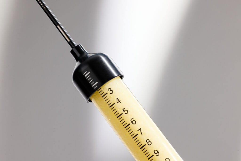 AlloClae fat injections
